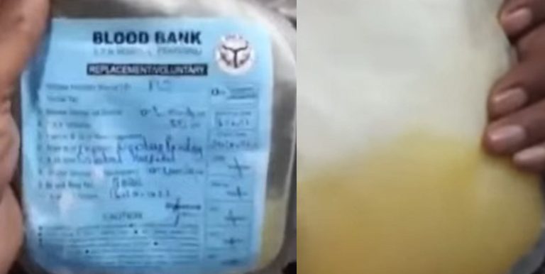 डेंगू मरीज को ‘मौसम्बी जूस’ चढ़ाने वाले अस्पताल पर चलेगा बुलडोजर